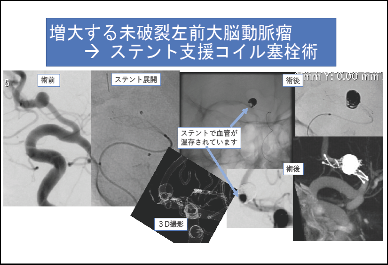 無題5