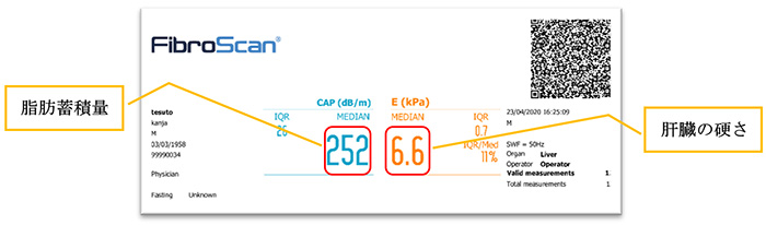 肝臓の硬さ・脂肪蓄積量